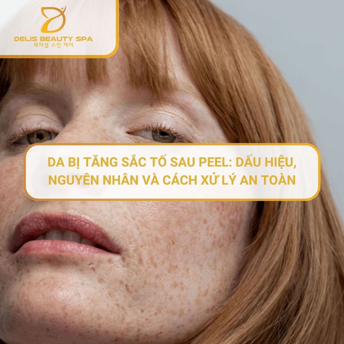 delis-spa-nha-trang
