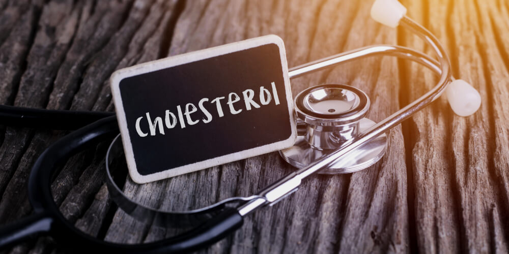 Cholesterol