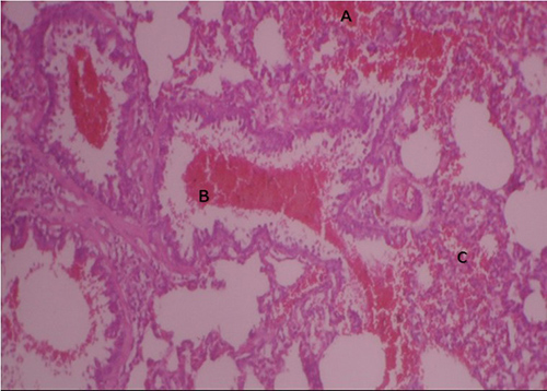 Micrograph of the Experimental lung showing: (A). severe interstitial haemorrhage, B. severe bronchiolar haemorrhage. C. patchy alveolar collapse and haemorrhage (H&E X100)