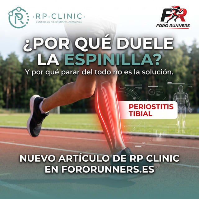 Periostitis tibial: por qué duele la espinilla y por qué parar del todo no la arregla