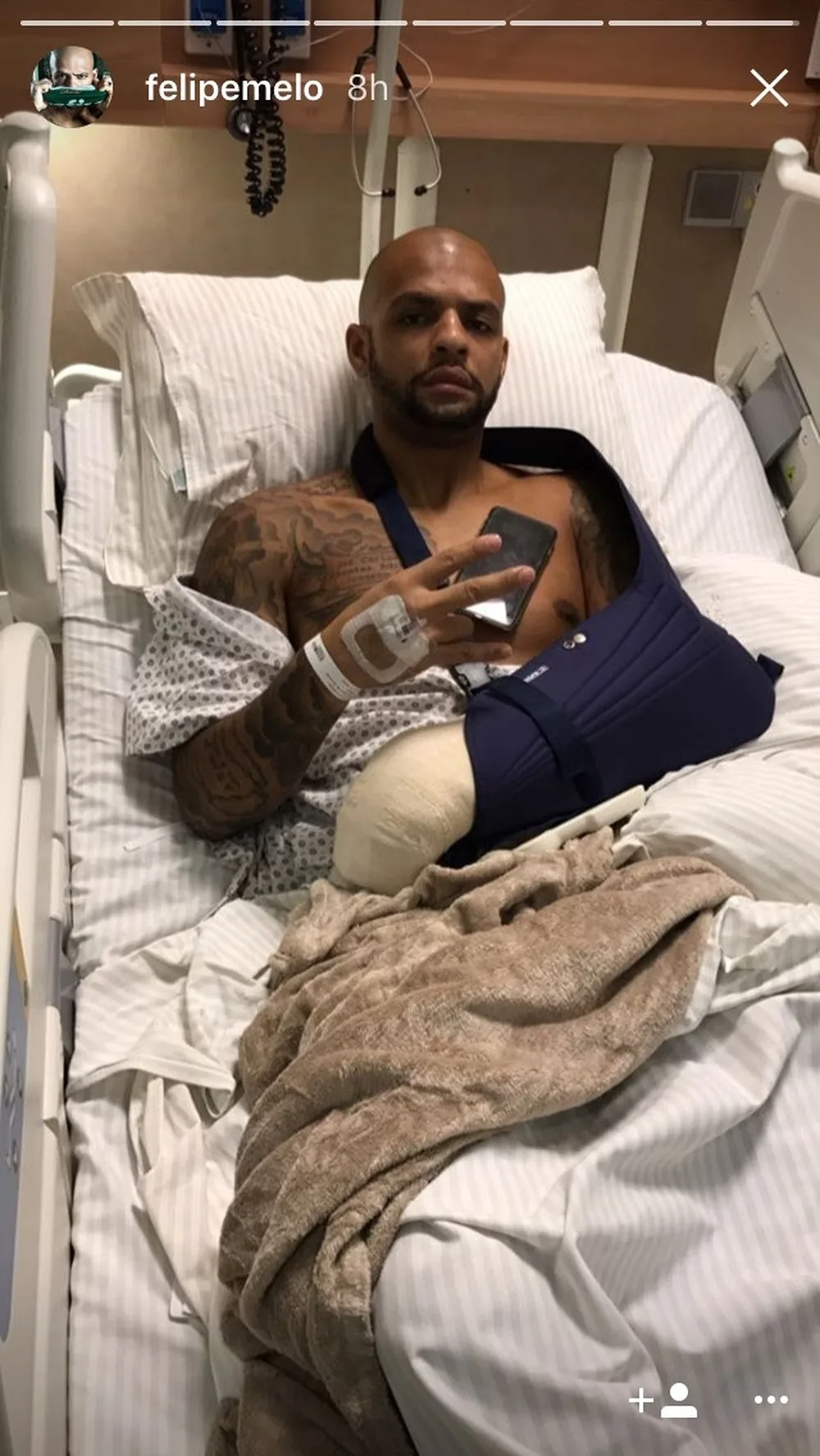 Felipe Melo comemora sucesso de cirurgia na mão: Ousado grogue