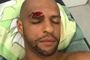 Marcas do clássico: Felipe Melo aparece com supercílio aberto no vestiário