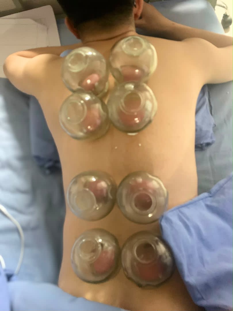 Advanced kidney disease treatment procedure performed by nephrology specialists at an international kidney hospital in China.