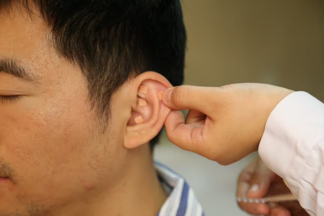Advanced kidney disease treatment procedure performed by nephrology specialists at an international kidney hospital in China.