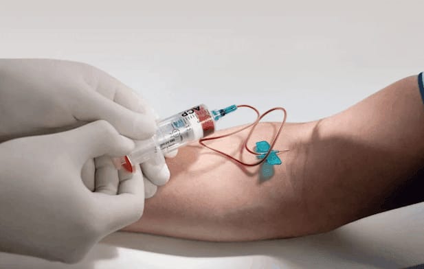 Platelet-Rich Fibrin