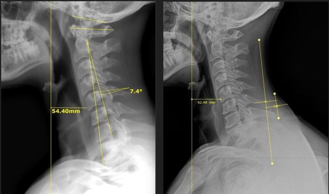 Denver Chiro 2 Medium.jpeg