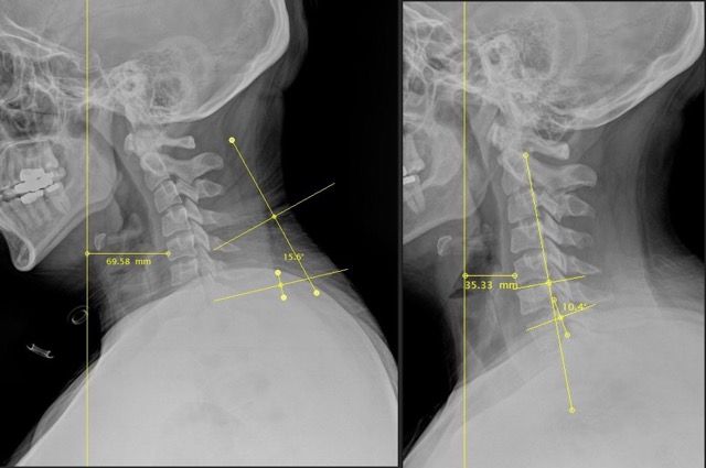Denver Chiro 3 Medium.jpeg