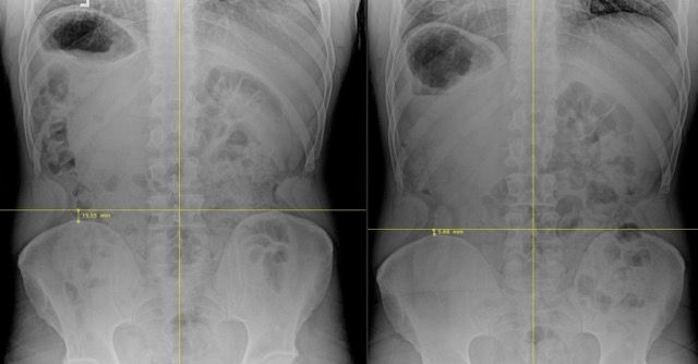 Sciatica 2 Medium.jpeg