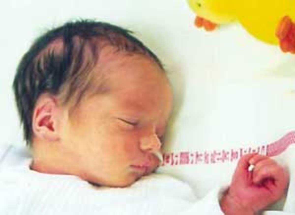 Classifying Seizures In The Very Young Initial Plans Of The Neonatal Seizure Task Force Part Of Ilae Commission On Classification Terminology International League Against Epilepsy