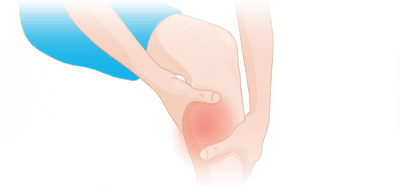 Calf pain