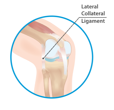 Lateral collateral ligament