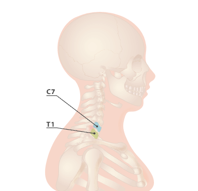 Cervicothoracic Junction