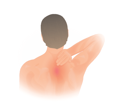 Upper back pain