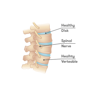 Healthy spine