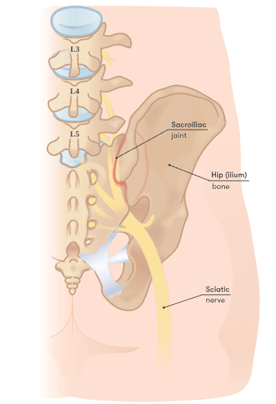 Sacroiliac joint