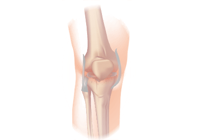 Pain in your knee joint