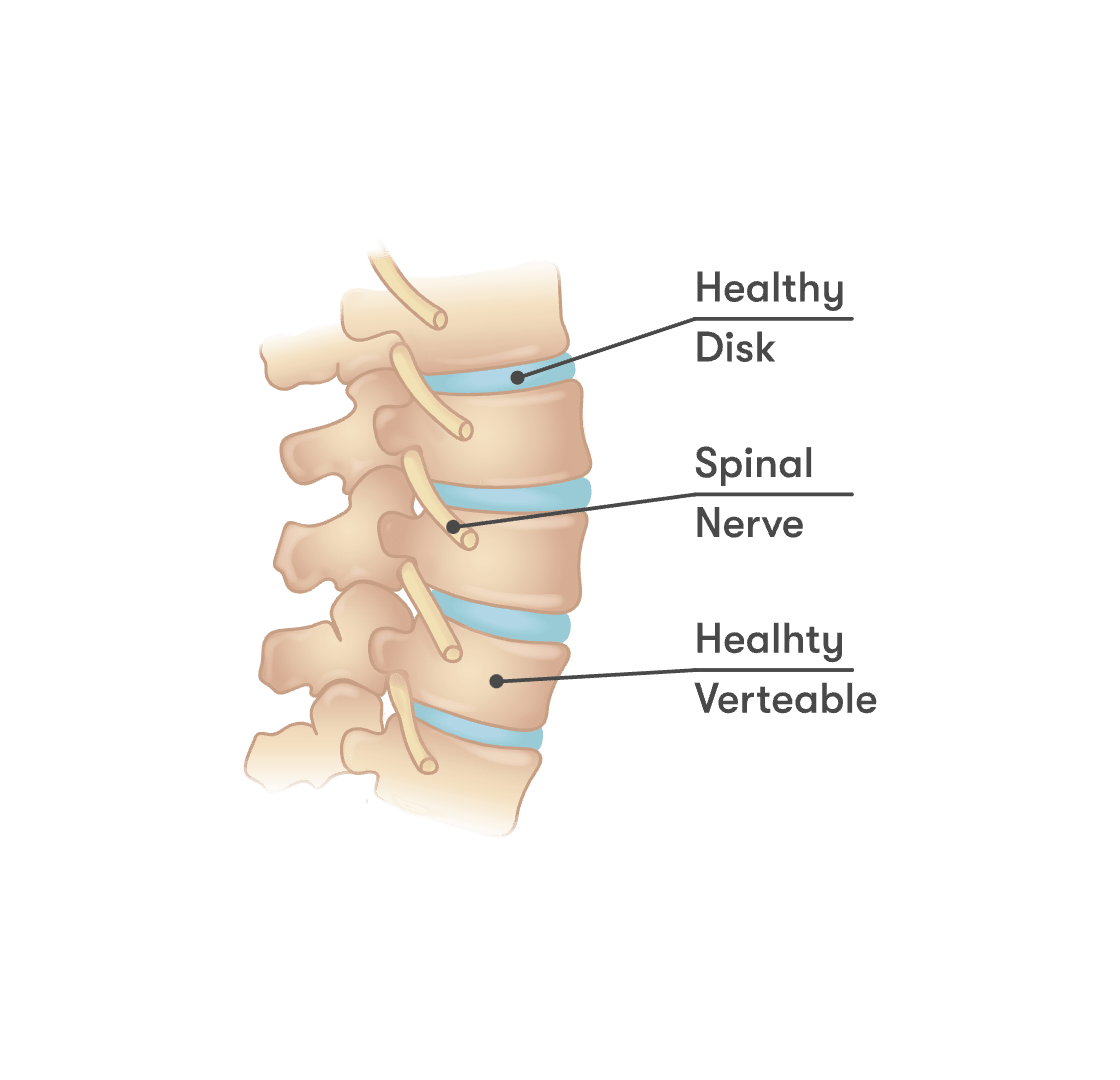 Pinched Shoulder Blade Nerve Symptoms And Pain Relief