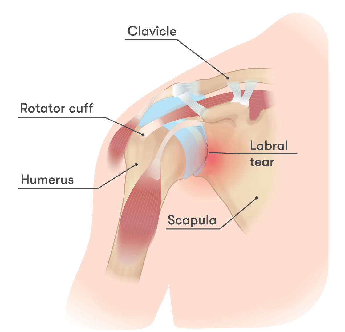 My shoulder snaps and pops and I hear clicking … why?