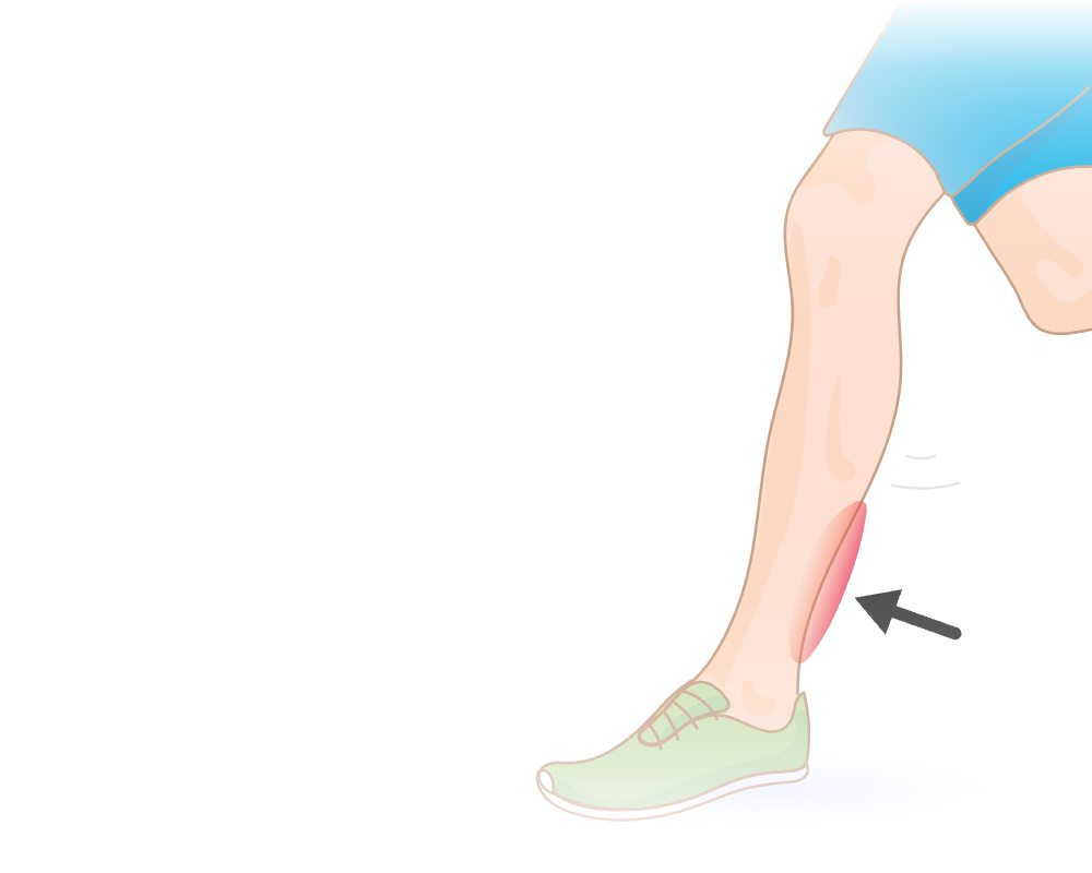 Gas Pedal Knee Ranarinz