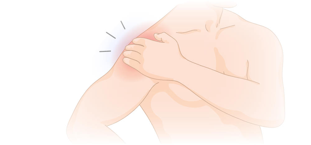 Shoulder Popping, Clicking and Cracking: What Does It Mean?