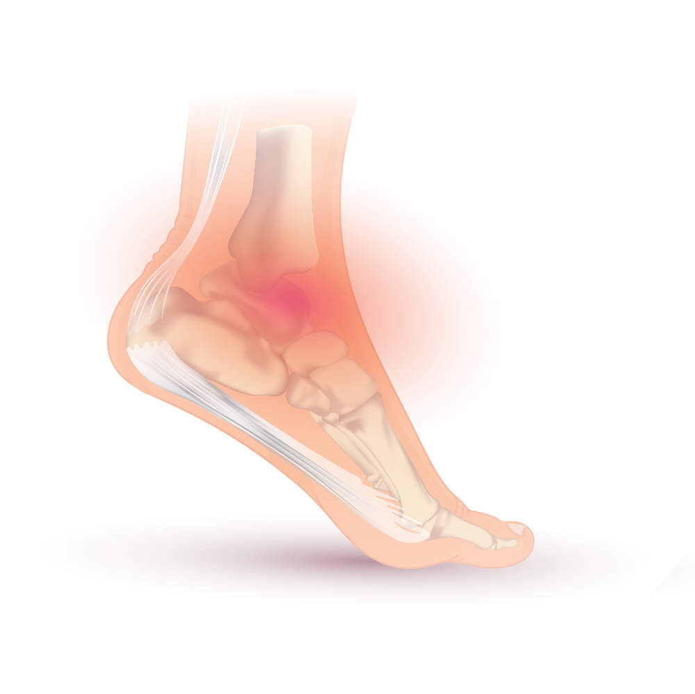 sprained ankle symptoms pain