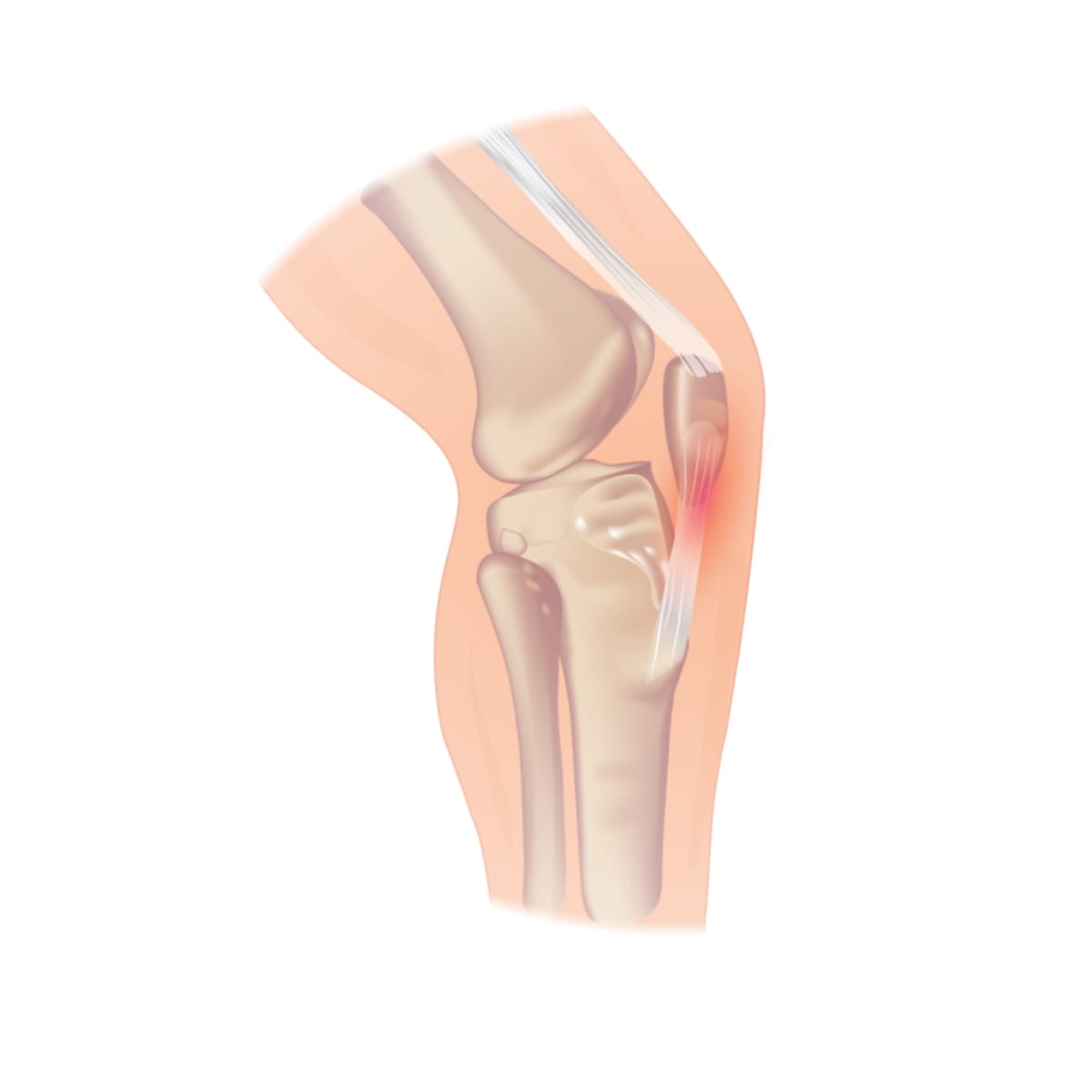 Knee Colwelaw