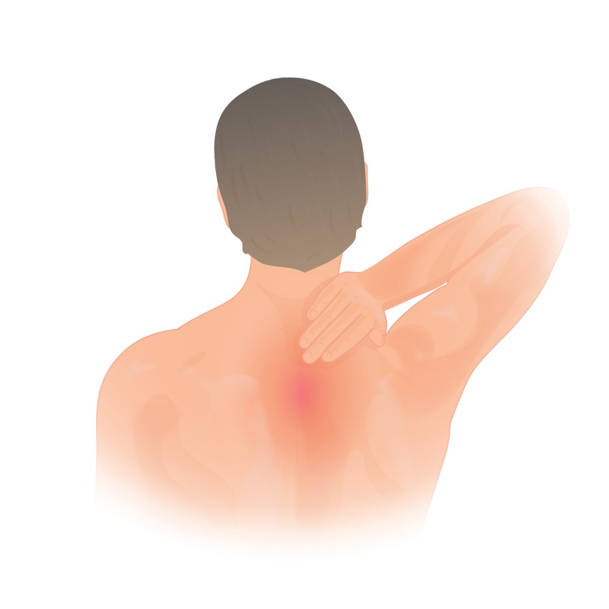 Massage Trapezius Muscle to Fix Dowager's Hump