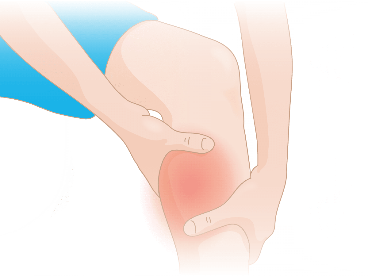 Right leg. Contraction of the Calf muscles when Climbing on the Toes.