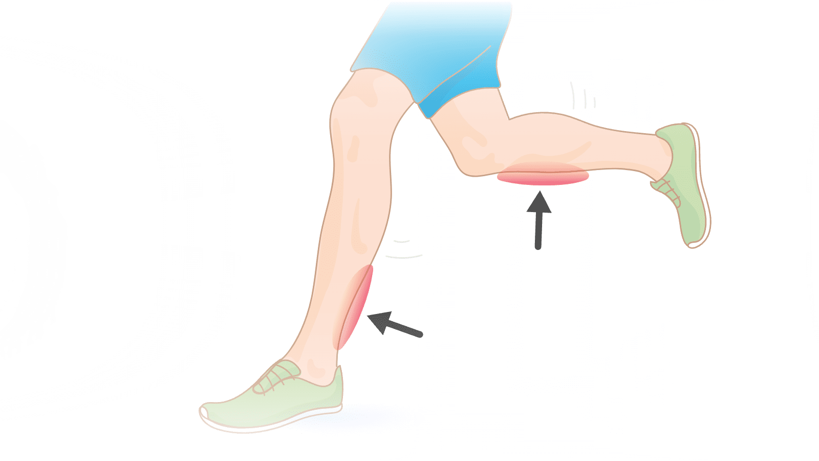 How to Get Rid of Stiff Legs, Calf Pain and Shin Splints After Running