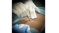 FundamentalVR debuts simulated soft tissue features