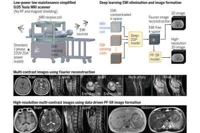 Machine learning to enable cheaper and safer low-power MRI scanners