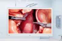 LG launches 4K surgical monitor