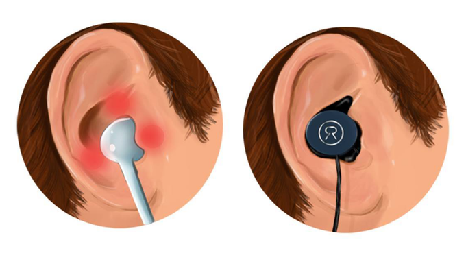 Generic (left) versus Revols custom-fit (right)