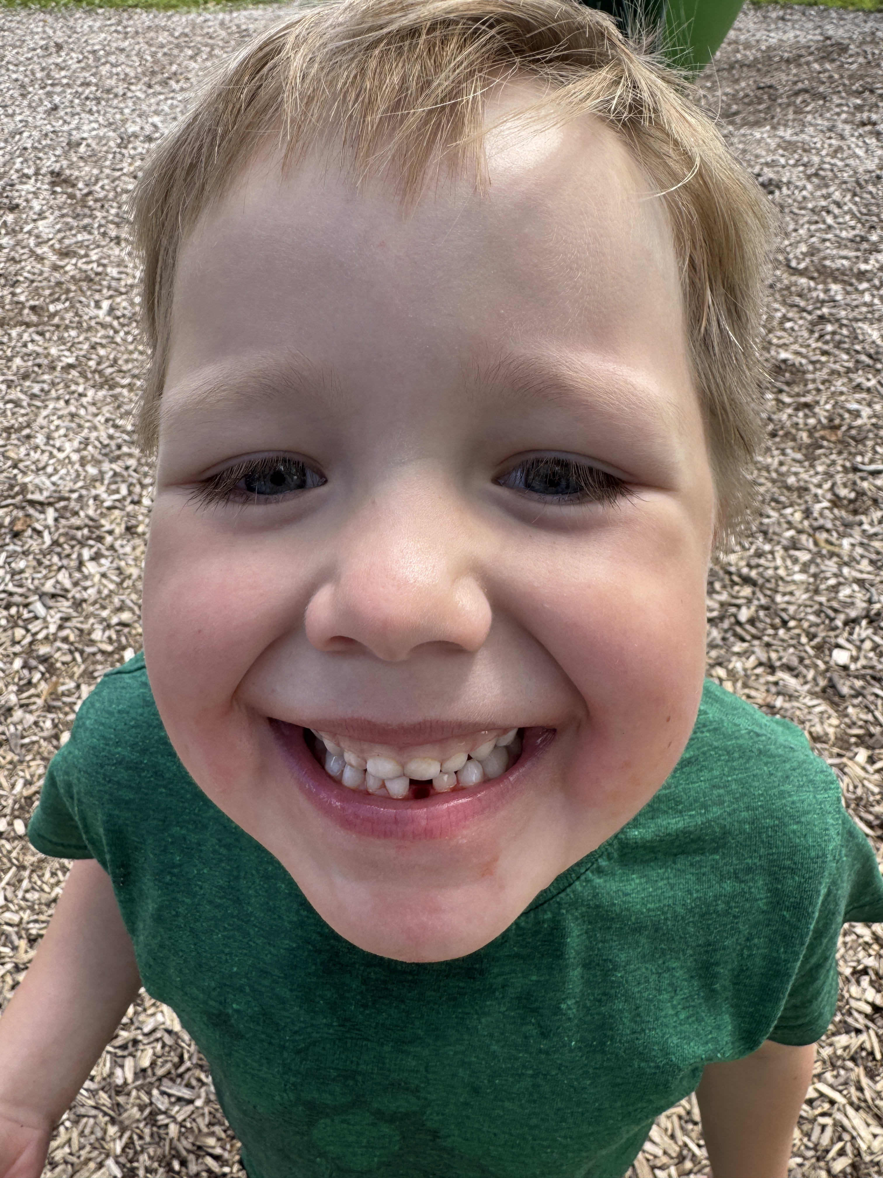 First lost tooth!