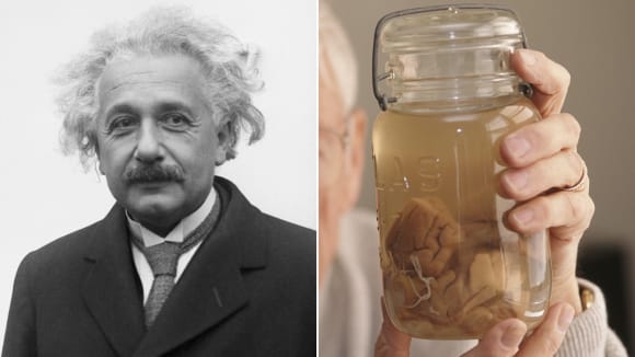 Das Gehirn von Albert Einstein Das Gehirn von Albert Einstein
