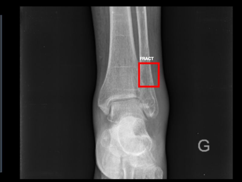 prod-airsaas/fwnkypglwzihtuiekvym