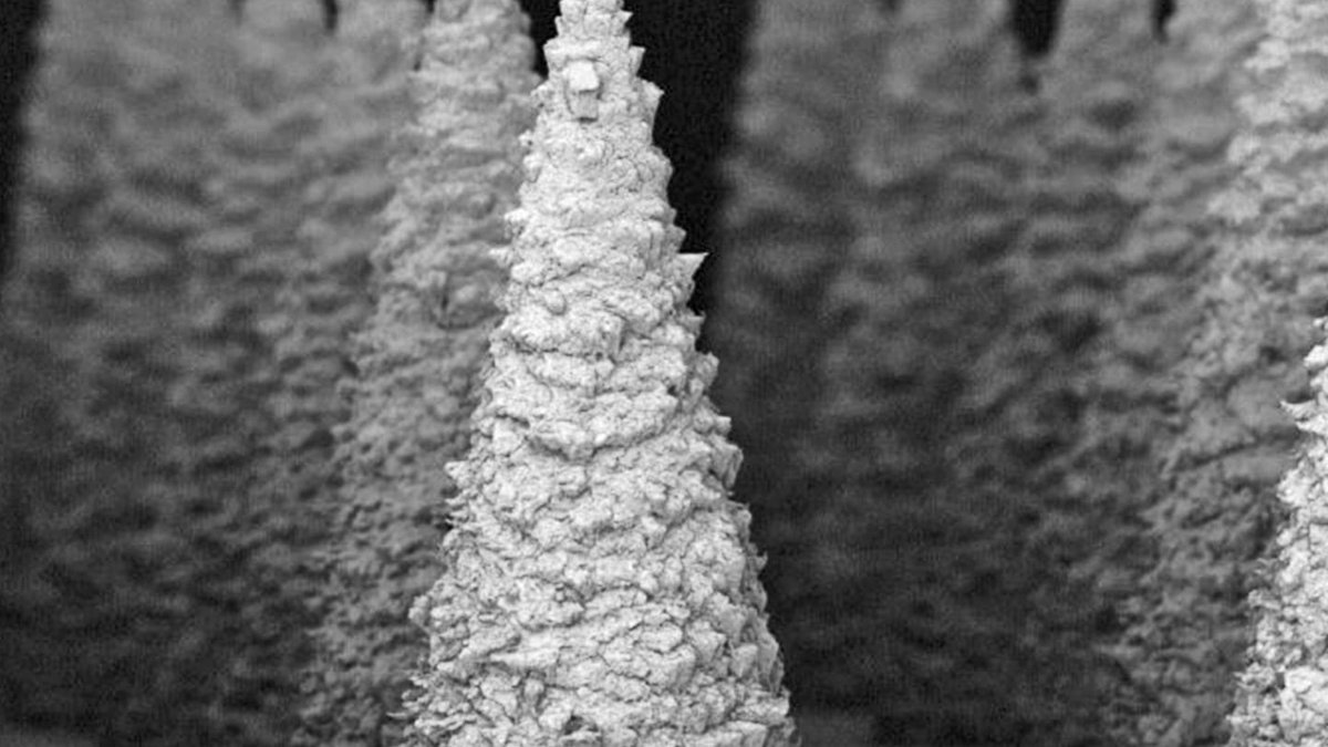 Microneedle patch detects kidney disease early - kidney disease
