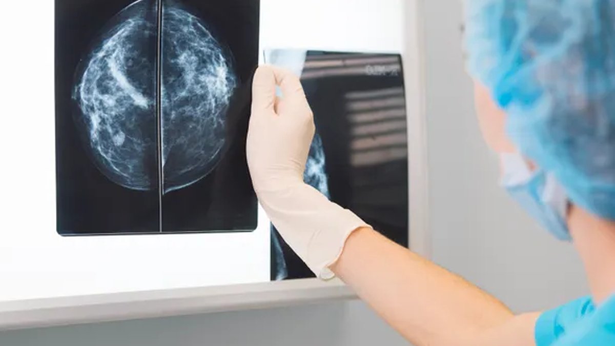 Vara Gets CE Mark for AI Breast Cancer Screening Vara Gets CE Mark for AI Breast Cancer Screening - ai breast cancer screening