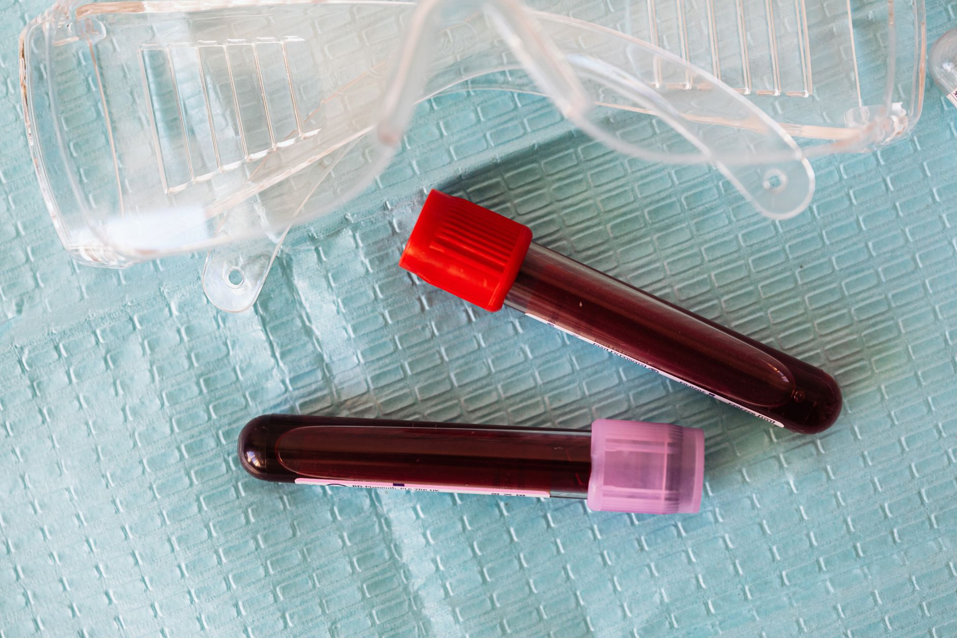 New noninvasive tests simplify MASLD, MASH detection