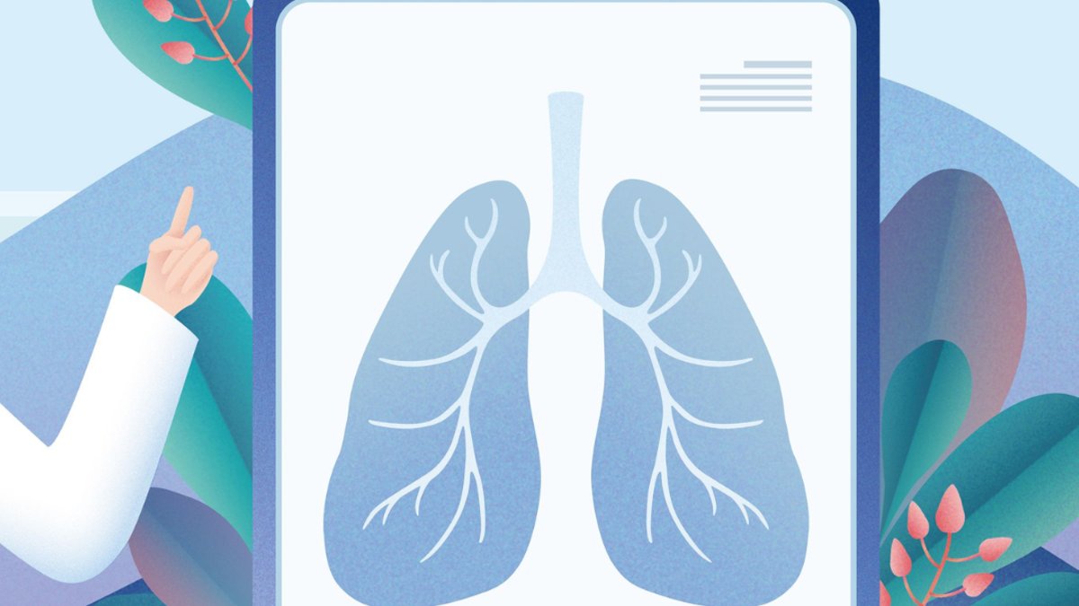 Enhertu extends progression-free survival in HER2 lung cancer - her2 lung cancer