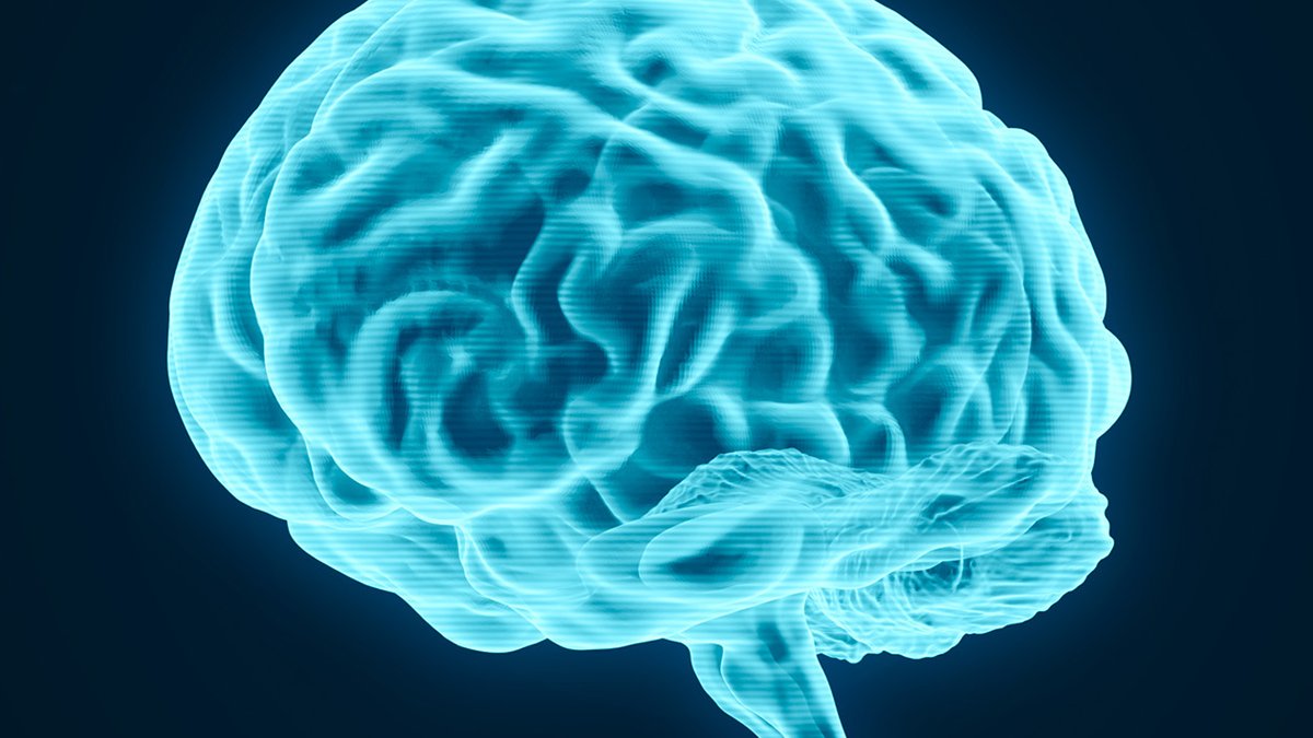 AI Enhances Aneurysm Detection but Increases False Alarms AI Enhances Aneurysm Detection but Increases False Alarms - aneurysm detection