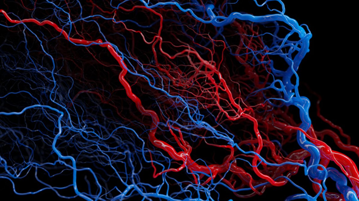 Tumor Blood Vessel Profiles Predict Colorectal Cancer Survival Tumor Blood Vessel Profiles Predict Colorectal Cancer Survival - tumor blood vessels