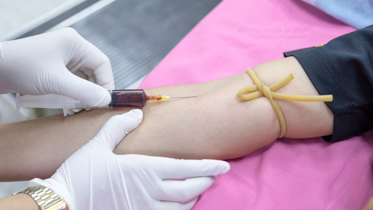 Managing Polycythemia Vera: Treatment Options and Expectations A medical professional takes a blood sample from a patient for testing.