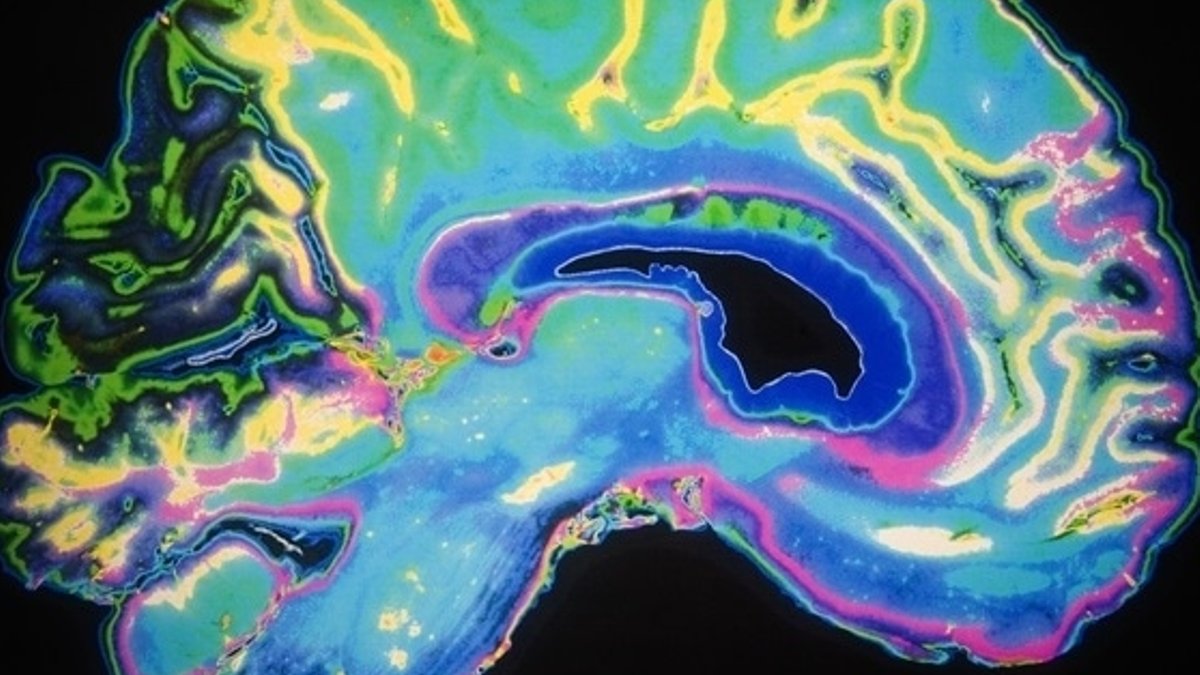 Liver loss drives seizures while brain loss depresses Liver loss drives seizures while brain loss depresses - liver loss