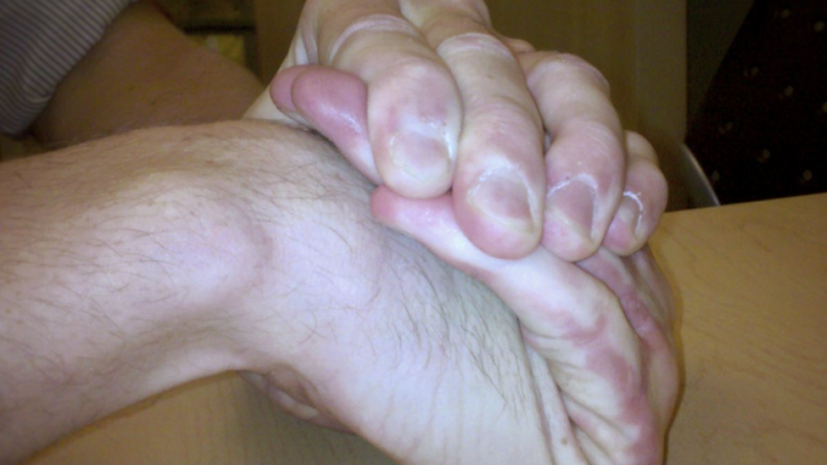 Physician Finds Flexibility Is Actually a Medical Condition Physician Finds Flexibility Is Actually a Medical Condition - flexibility medical condition