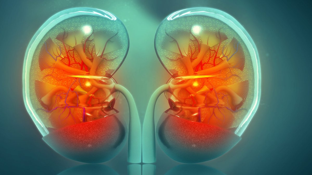 Gene therapy startup targets ADPKD’s root cause - gene therapy adpkd