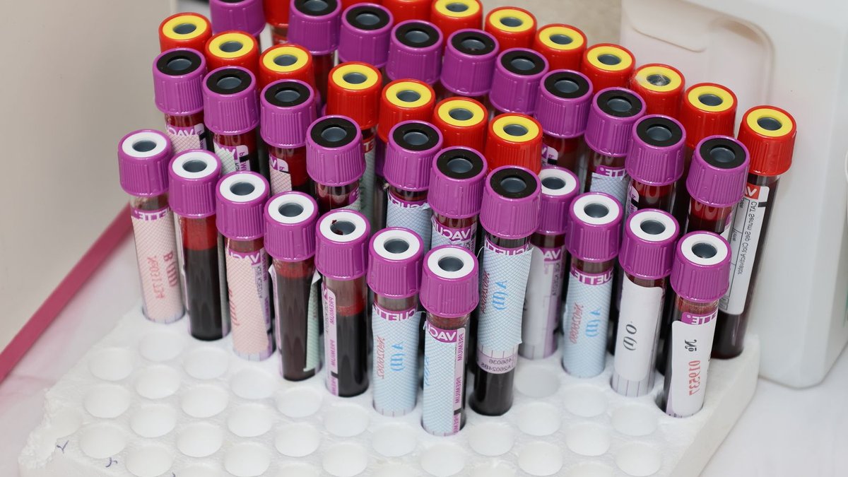Nathan Fielder’s Documentary Questions Elizabeth Holmes’ Guilt Rows of blood vials in a laboratory setting, ready for analysis.