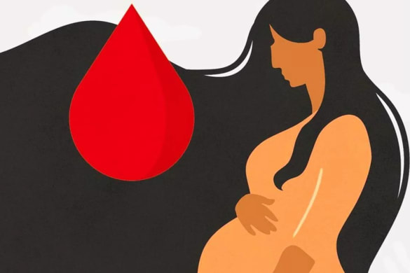 Maternal deaths persist despite WHO guidelines in global study