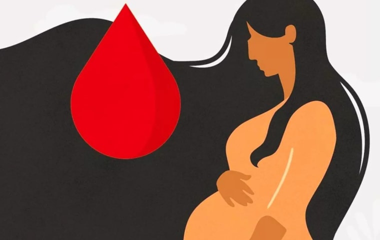 Maternal deaths persist despite WHO guidelines in global study