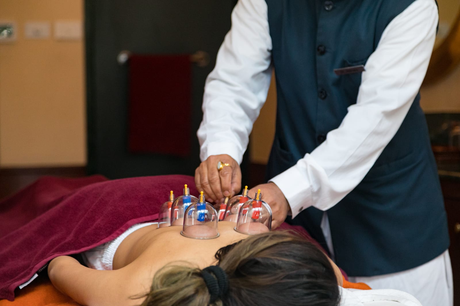 Wellness_Oriental Therapy 3 Practitioner performing cupping therapy on patient's back with glass cups